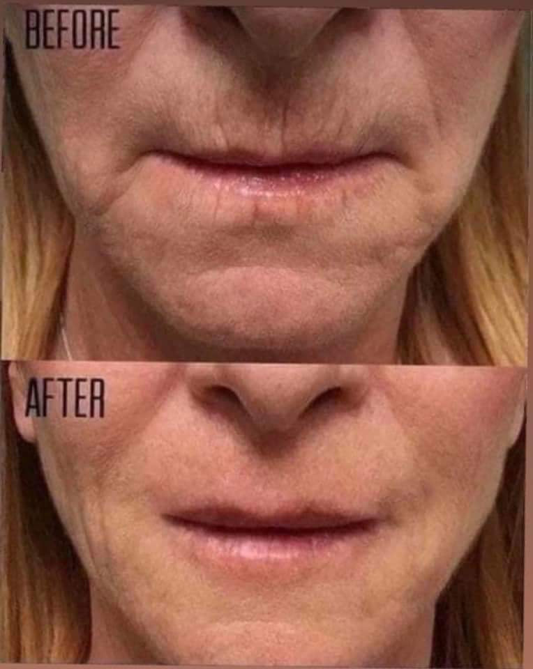 Uplifting Cream