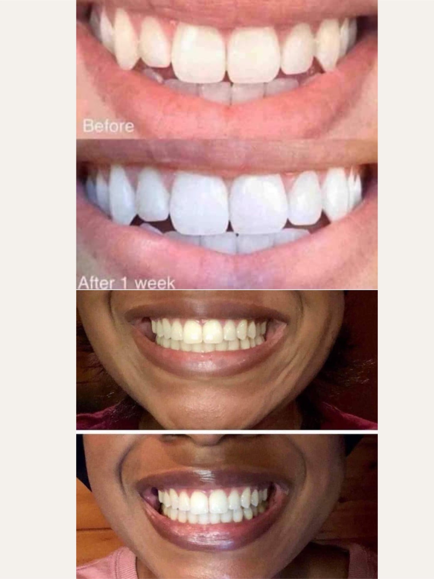 Whitening Toothpaste