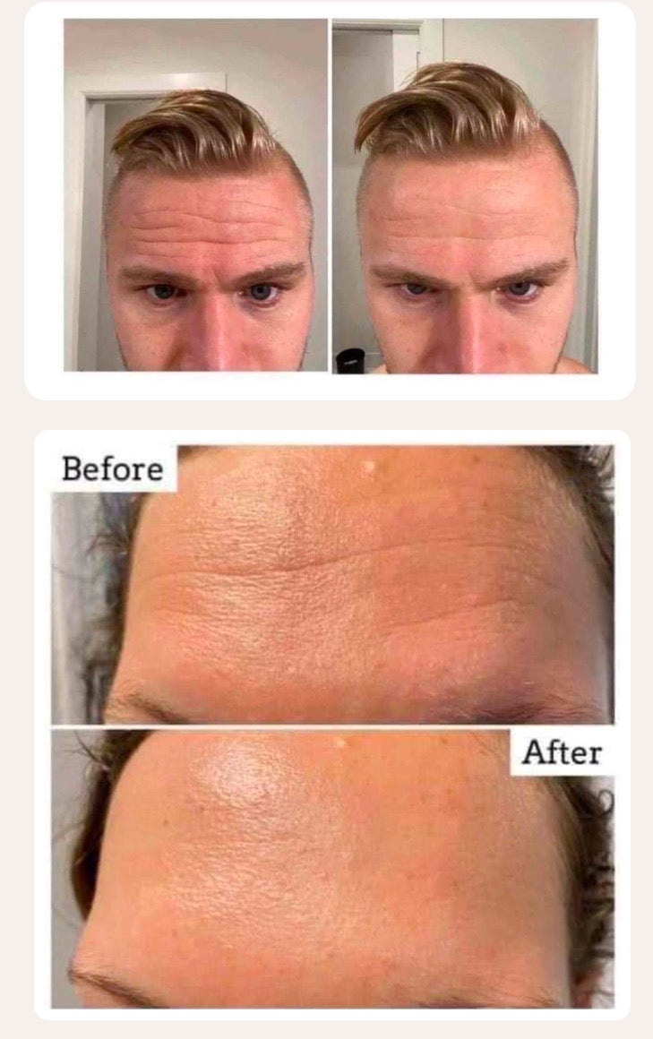 Tru Face® Line Corrector