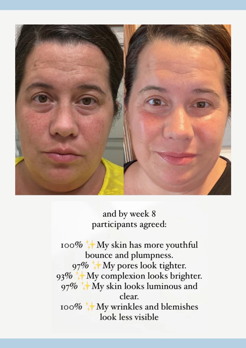 Retinol